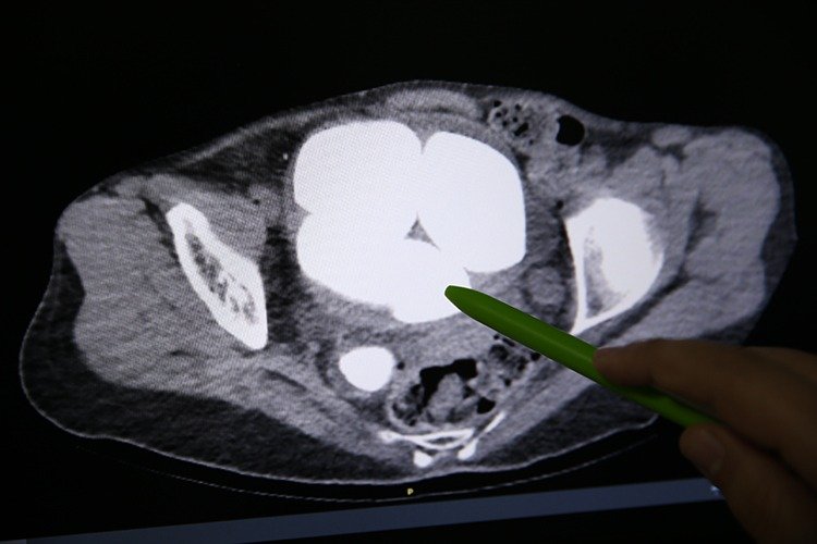 I M G 20260401 W A0038