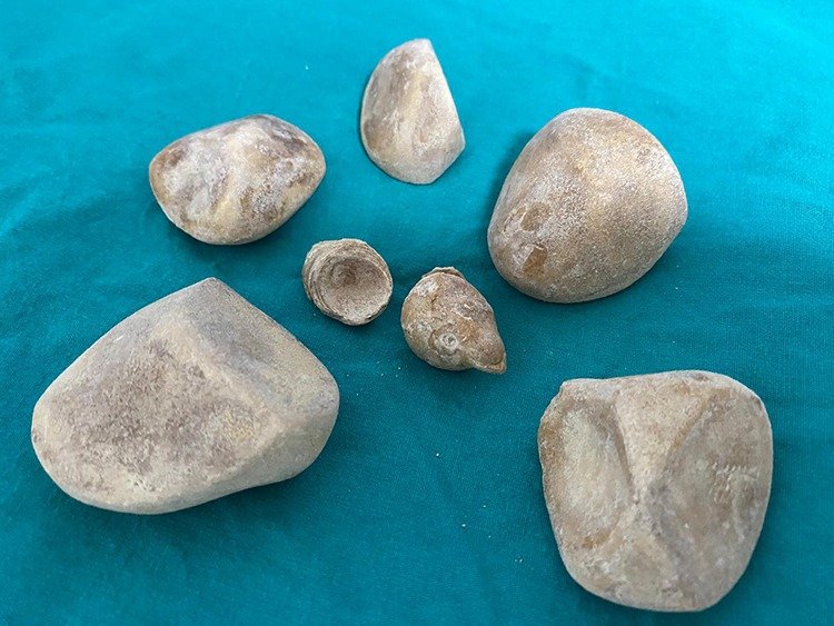 I M G 20260401 W A0039