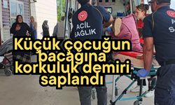 Küçük çocuğun bacağına korkuluk demiri saplandı