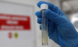 DSÖ: Tüberküloz nedeniyle her yıl bir milyon kişi hayatını kaybediyor