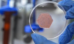 "Yara örtüsü" kronik yaralar için umut olacak