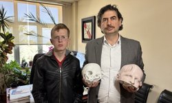 Yüzdeki şekil bozukluğu "3 boyutlu teknoloji"yle düzeltildi