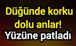 Düğünde korku dolu anlar! Yüzüne patladı