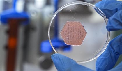 "Yara örtüsü" kronik yaralar için umut olacak