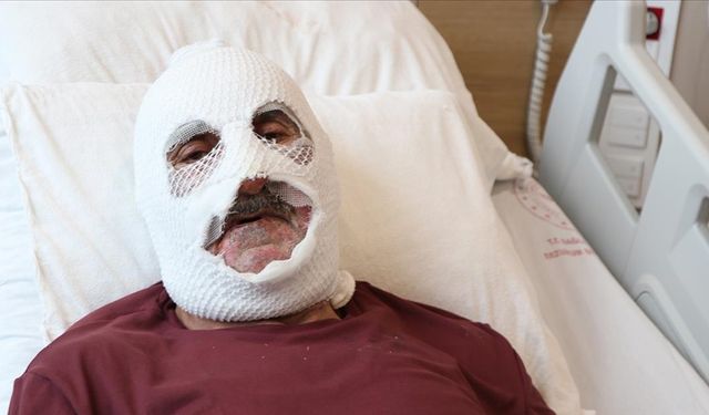 Gaz kaçağını çakmakla kontrol etti, hastanelik oldu (Video)