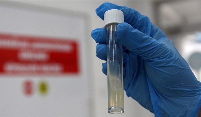 DSÖ: Tüberküloz nedeniyle her yıl bir milyon kişi hayatını kaybediyor