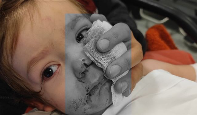 2 çocuğu yaralayan pitbull cinsi köpeğin sahibi tutuklandı