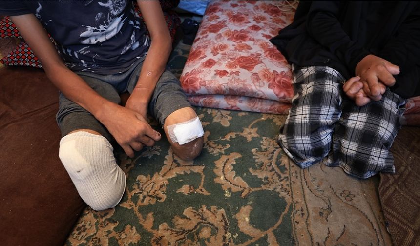 Gazze nüfusa oranla dünyada en fazla ampute çocuk sayısına sahip