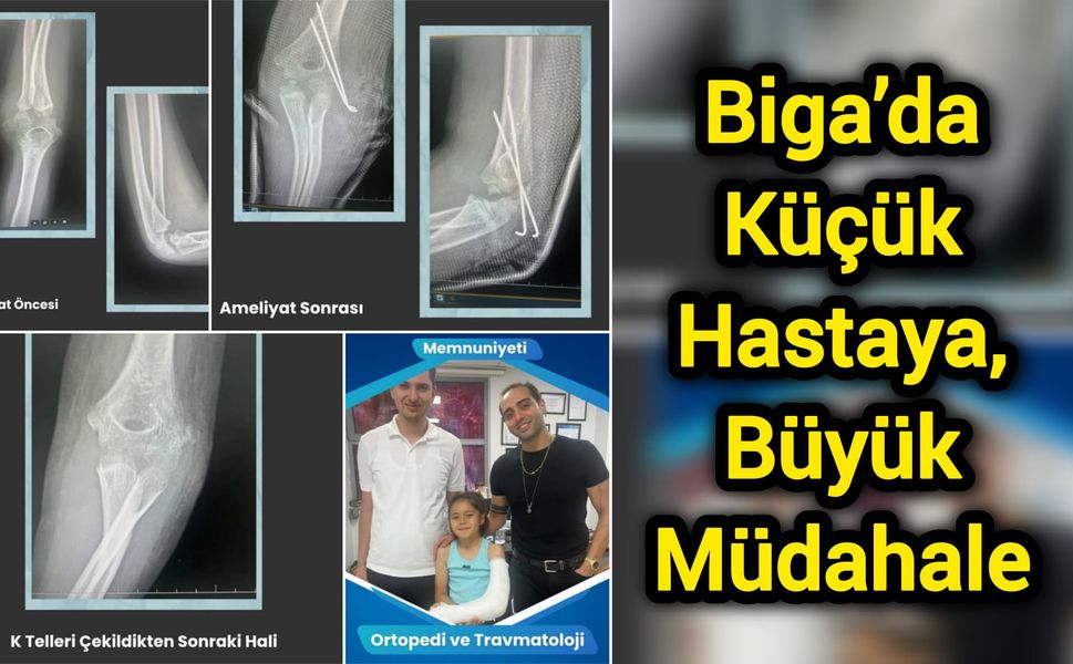 Biga’da Küçük Hastaya Büyük Müdahale
