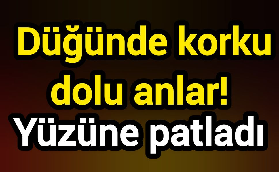 Düğünde korku dolu anlar! Yüzüne patladı